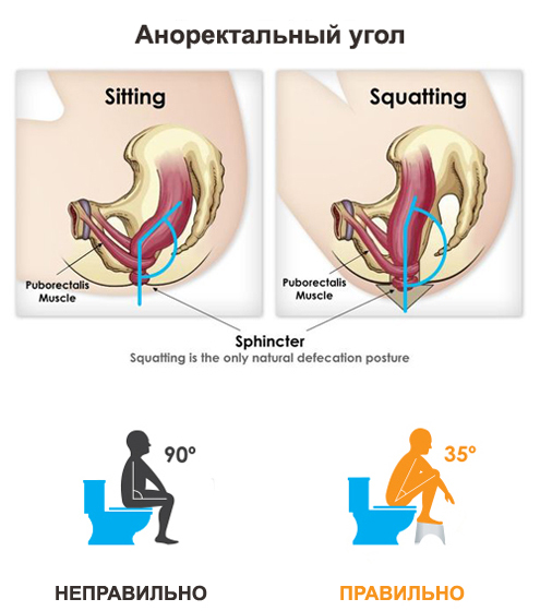 Как правильно сидеть на унитазе